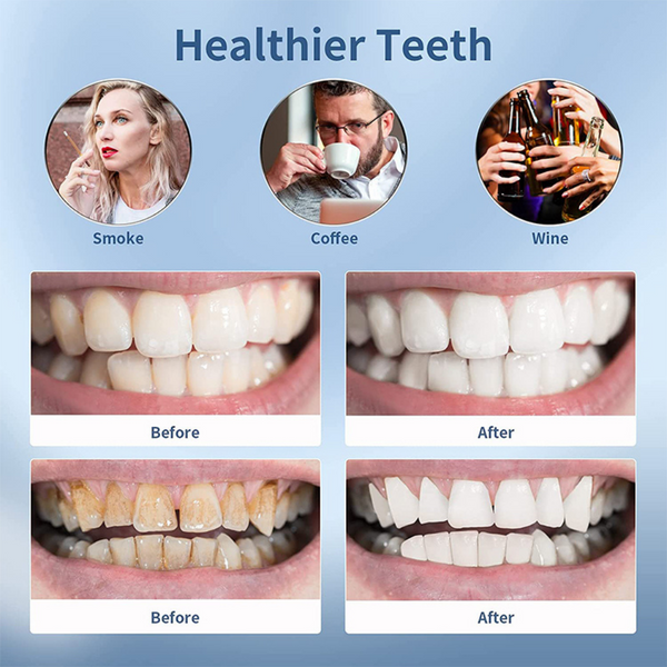 Sonic Dental Calculus Scaler