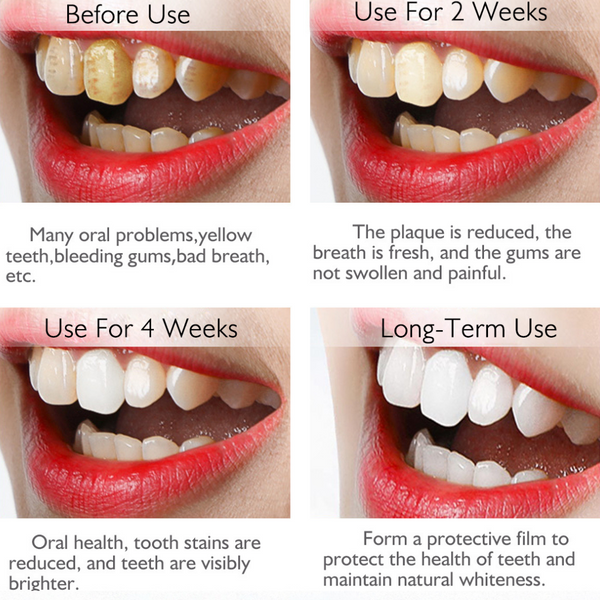 Mint Teeth Cleansing Whitening Mousse