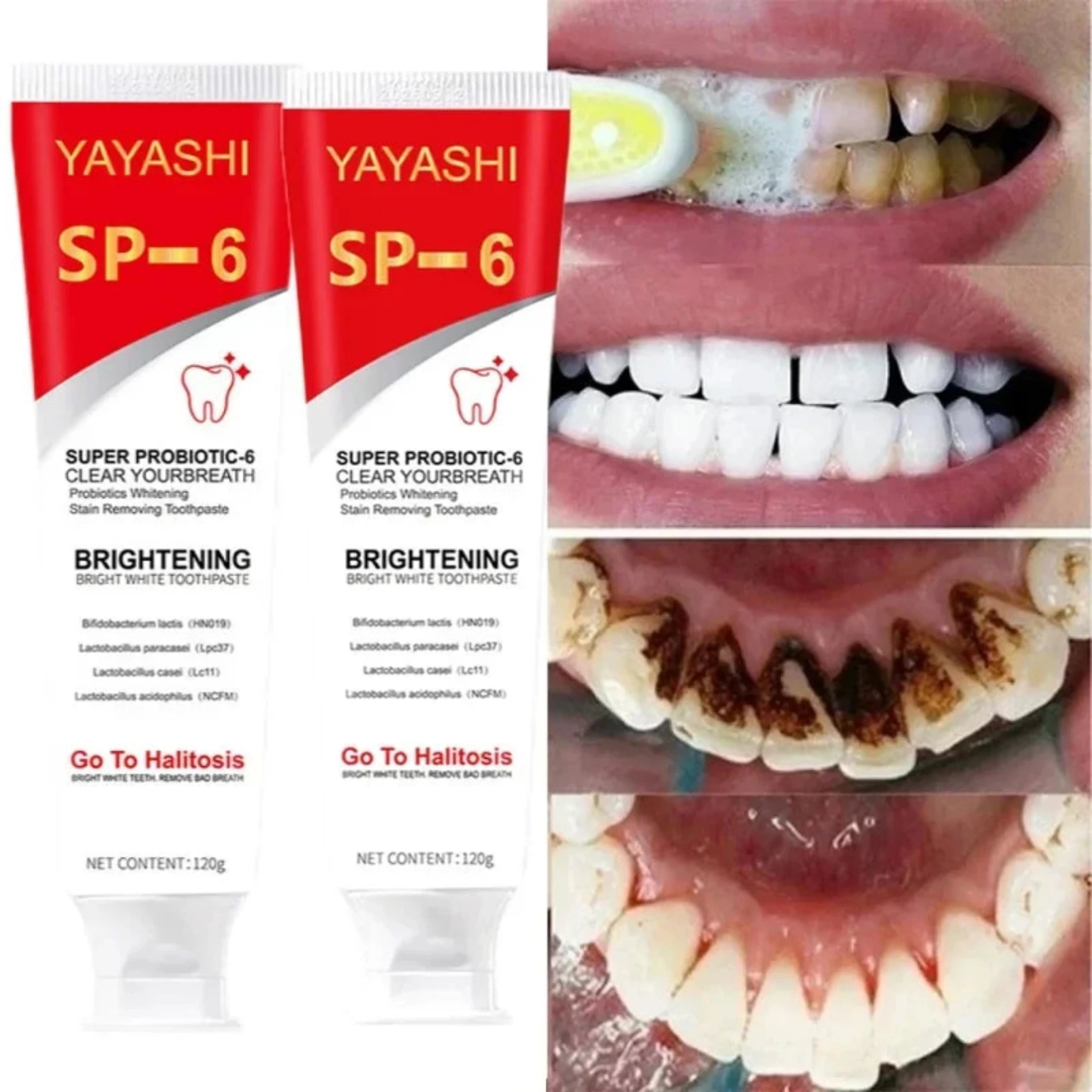 Probiotic SP-6 Stains Remover Teeth Whitening Toothpaste