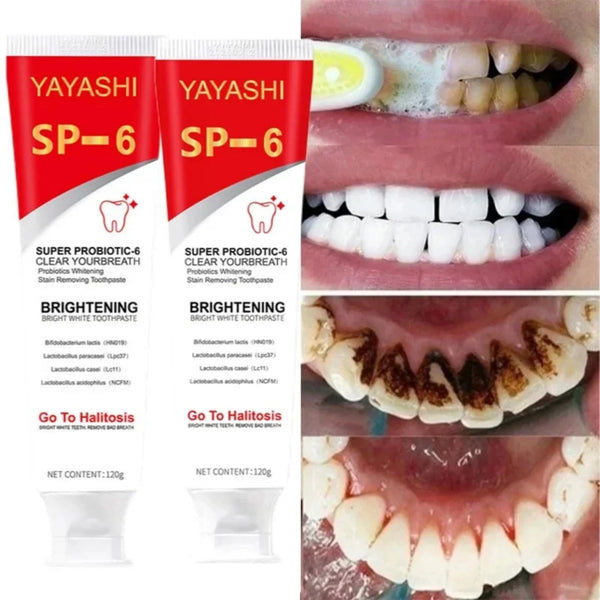 Probiotic SP-6 Stains Remover Teeth Whitening Toothpaste