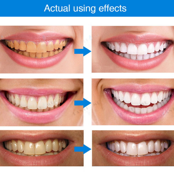The Sparkling Teeth Whitening Essence